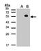 TGF-Beta Activated Kinase 1 (MAP3K7) Binding Protein 1 antibody, GTX103200, GeneTex, Western Blot image 