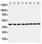 Ataxin 3 antibody, PA1846, Boster Biological Technology, Western Blot image 