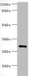Fibroblast Growth Factor 23 antibody, A55822-100, Epigentek, Western Blot image 