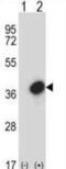 General Transcription Factor IIE Subunit 2 antibody, abx027804, Abbexa, Western Blot image 