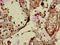 Ring Finger Protein 126 antibody, orb50998, Biorbyt, Immunohistochemistry paraffin image 