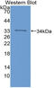 Integrin Subunit Alpha 1 antibody, LS-C314750, Lifespan Biosciences, Western Blot image 