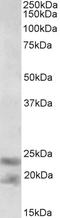 Interleukin 25 antibody, LS-C186529, Lifespan Biosciences, Western Blot image 