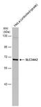 Sodium-dependent phosphate transport protein 2B antibody, PA5-78333, Invitrogen Antibodies, Western Blot image 