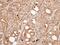 Protein Phosphatase 3 Catalytic Subunit Alpha antibody, NBP1-32720, Novus Biologicals, Immunohistochemistry paraffin image 