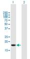 ALG13 UDP-N-Acetylglucosaminyltransferase Subunit antibody, H00079868-B01P, Novus Biologicals, Western Blot image 