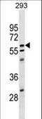 Copine 5 antibody, LS-C159400, Lifespan Biosciences, Western Blot image 