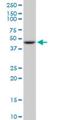 Glutamic-Oxaloacetic Transaminase 2 antibody, H00002806-M09, Novus Biologicals, Western Blot image 