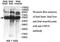 Dual Specificity Phosphatase 10 antibody, MBS416235, MyBioSource, Western Blot image 