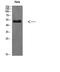 Endothelin Receptor Type B antibody, STJ98617, St John