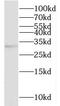 Metabolism Of Cobalamin Associated C antibody, FNab05227, FineTest, Western Blot image 