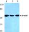 Adrenoceptor Alpha 1B antibody, A04856-1, Boster Biological Technology, Western Blot image 