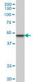 SWI/SNF Related, Matrix Associated, Actin Dependent Regulator Of Chromatin, Subfamily B, Member 1 antibody, LS-B6039, Lifespan Biosciences, Western Blot image 