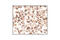 Fms Related Tyrosine Kinase 3 antibody, 3462S, Cell Signaling Technology, Immunohistochemistry paraffin image 