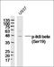 NFKB Inhibitor Beta antibody, orb157672, Biorbyt, Western Blot image 