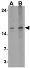 Interferon Lambda 3 antibody, GTX31893, GeneTex, Western Blot image 