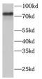 Threonyl-TRNA Synthetase 2, Mitochondrial antibody, FNab08502, FineTest, Western Blot image 