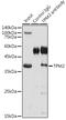 Tropomyosin 2 antibody, GTX16425, GeneTex, Immunoprecipitation image 