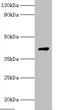 Guanine nucleotide-binding protein G(o) subunit alpha antibody, A55105-100, Epigentek, Western Blot image 