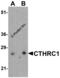 Collagen Triple Helix Repeat Containing 1 antibody, 8101, ProSci, Western Blot image 