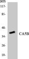 Carbonic Anhydrase 5B antibody, LS-C291747, Lifespan Biosciences, Western Blot image 
