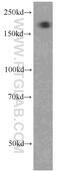 Alpha-2-Macroglobulin antibody, 66126-1-Ig, Proteintech Group, Western Blot image 