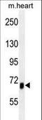 Activin A Receptor Type 1B antibody, LS-C156021, Lifespan Biosciences, Western Blot image 