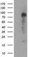 Transforming Acidic Coiled-Coil Containing Protein 3 antibody, TA501254, Origene, Western Blot image 