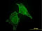 Calcium And Integrin Binding 1 antibody, LS-C133650, Lifespan Biosciences, Immunofluorescence image 