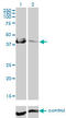 Carbonic Anhydrase 12 antibody, LS-C196797, Lifespan Biosciences, Western Blot image 