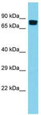 Golgi Associated, Gamma Adaptin Ear Containing, ARF Binding Protein 2 antibody, TA343361, Origene, Western Blot image 