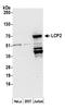 Lymphocyte Cytosolic Protein 2 antibody, A305-243A, Bethyl Labs, Western Blot image 