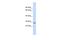 Chymotrypsin C antibody, A03540, Boster Biological Technology, Western Blot image 