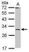 Ribonuclease P/MRP Subunit P30 antibody, NBP2-20221, Novus Biologicals, Western Blot image 