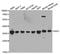 HCLS1 Associated Protein X-1 antibody, A5551, ABclonal Technology, Western Blot image 