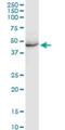 Keratin 35 antibody, H00003886-D01P, Novus Biologicals, Western Blot image 