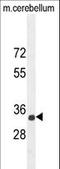 Cell adhesion molecule 1 antibody, LS-C168268, Lifespan Biosciences, Western Blot image 