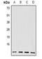 BH3-Like Motif Containing, Cell Death Inducer antibody, orb341262, Biorbyt, Western Blot image 