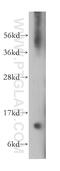 Vesicle Associated Membrane Protein 1 antibody, 13115-1-AP, Proteintech Group, Western Blot image 