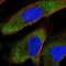 YTH N6-Methyladenosine RNA Binding Protein 2 antibody, NBP2-68614, Novus Biologicals, Immunofluorescence image 