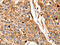 Cathepsin B antibody, orb518675, Biorbyt, Immunohistochemistry paraffin image 