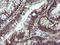NADPH Dependent Diflavin Oxidoreductase 1 antibody, LS-C787630, Lifespan Biosciences, Immunohistochemistry paraffin image 
