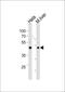 T-box transcription factor TBX6 antibody, PA5-35065, Invitrogen Antibodies, Western Blot image 