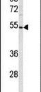 Prostacyclin synthase antibody, PA5-15218, Invitrogen Antibodies, Western Blot image 