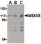 Interferon Induced With Helicase C Domain 1 antibody, PA5-20338, Invitrogen Antibodies, Western Blot image 