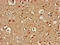 Autophagy Related 13 antibody, LS-C677219, Lifespan Biosciences, Immunohistochemistry paraffin image 