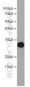 Orosomucoid 2 antibody, 11199-1-AP, Proteintech Group, Western Blot image 