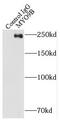 Myosin IXB antibody, FNab05509, FineTest, Immunoprecipitation image 
