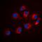 Insulin Receptor Substrate 1 antibody, orb315569, Biorbyt, Immunofluorescence image 