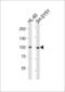 Mitogen-Activated Protein Kinase Kinase Kinase 12 antibody, MBS9214125, MyBioSource, Western Blot image 